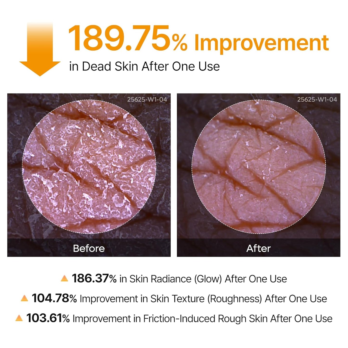 Body Keratin Care Kojic Acid Turmeric Spray Gently Exfoliating Peeling Solution Korean Skincare All Skin Types 200ml