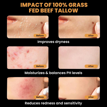 Organic Grass-Fed Beef Tallow Balm with Raw Honey - Moisturizing Cream for Soft, Smooth Skin - Handmade All-Natural Moisturizer 57g.