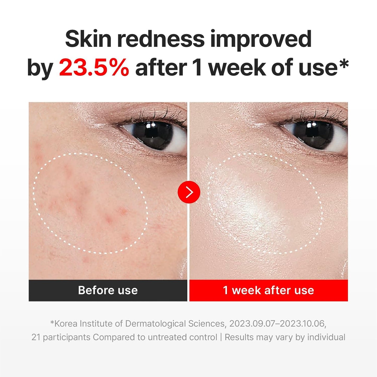 Madeca Time Reverse Cream – Korean Centella Anti-Aging Moisturizer | Hydrates, Firms & Reduces Wrinkles (1.69 fl oz)