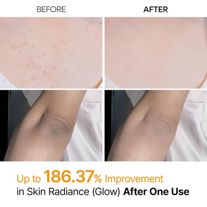 Body Keratin Care Kojic Acid Turmeric Spray Gently Exfoliating Peeling Solution Korean Skincare All Skin Types 200ml