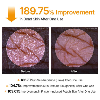 Body Keratin Care Kojic Acid Turmeric Spray Gently Exfoliating Peeling Solution Korean Skincare All Skin Types 200ml