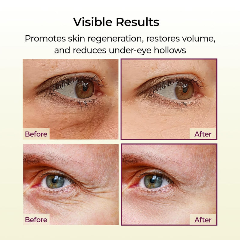 Calcium Multi Balm 9g Korean Skin Care All In One Calcium Volume Stick Collagen Wrinkles Face Eye treatment Balm