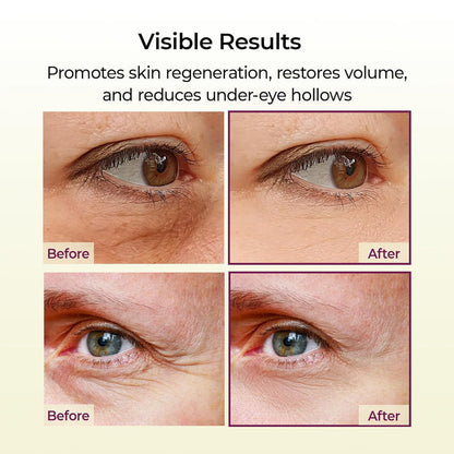 Calcium Multi Balm 9g Korean Skin Care All In One Calcium Volume Stick Collagen Wrinkles Face Eye treatment Balm